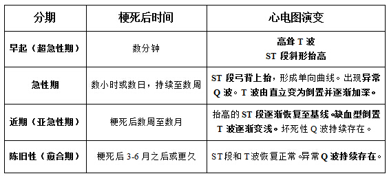 医疗卫生系统考试难点解析:急性心肌梗死的心电图表现